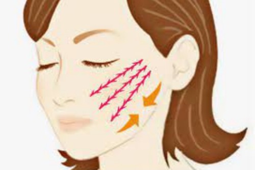 拉皮手術宣傳圖